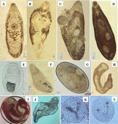  Phyllodistomum: Un Parasite Astucieux qui adore les Poissons et les Oiseaux!